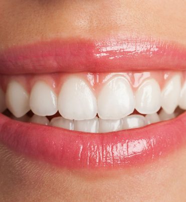 tedavilerimiz-dis-beyazlatma-1