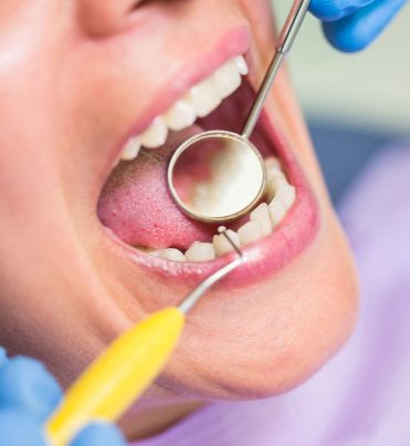 tedavilerimiz-kanal-tedavisi-1