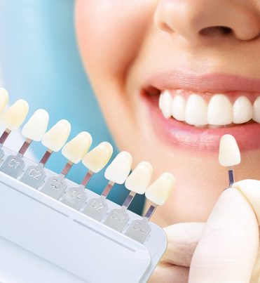 tedavilerimiz-porselen-kaplama-1